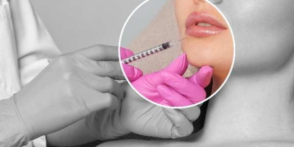 Rediscover Natural Expression with Modern Botox Techniques