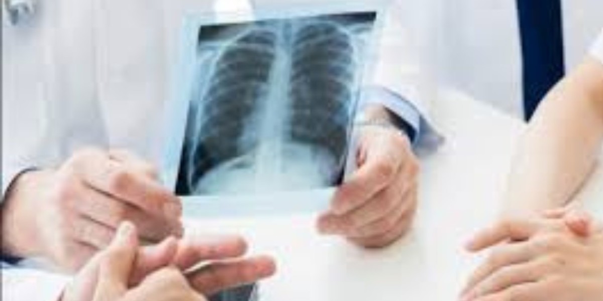 Nearest X Ray Lab: Finding the Right Diagnostic Center for Your Needs