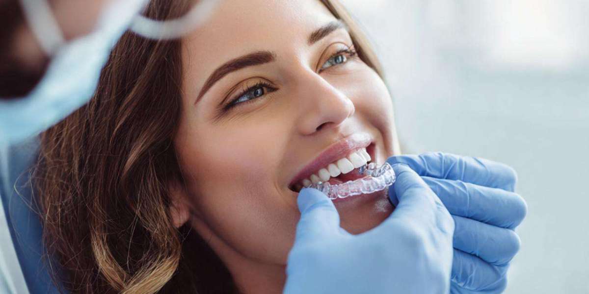 Color theory in Digital Smile Design: Choosing the right shade