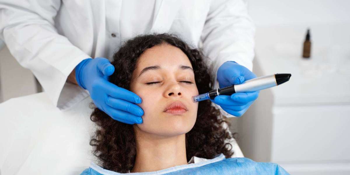 Microneedling Toronto to Fade Scars and Fine Lines Fast