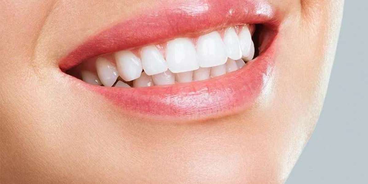 Best Orthodontists Share Tips for Maintaining Healthy Braces