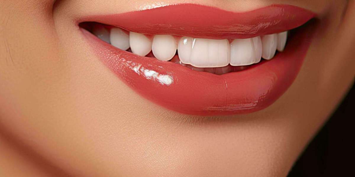Teeth Whitening Cost: Budgeting for a Brighter Smile