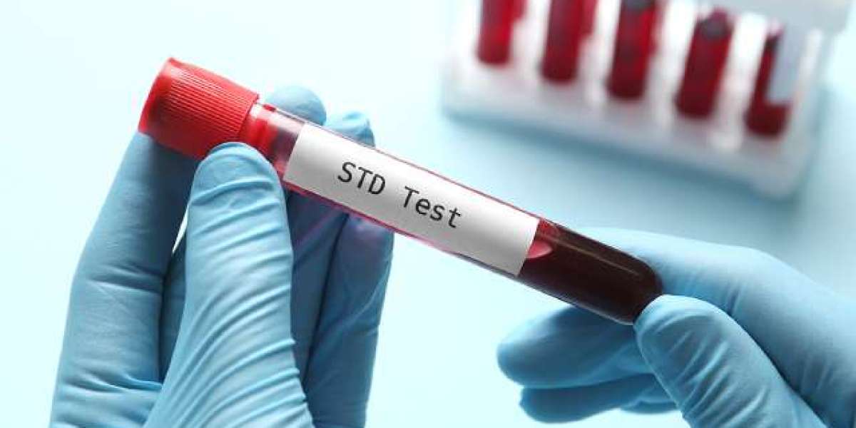STD Test and the Role of Early Screening