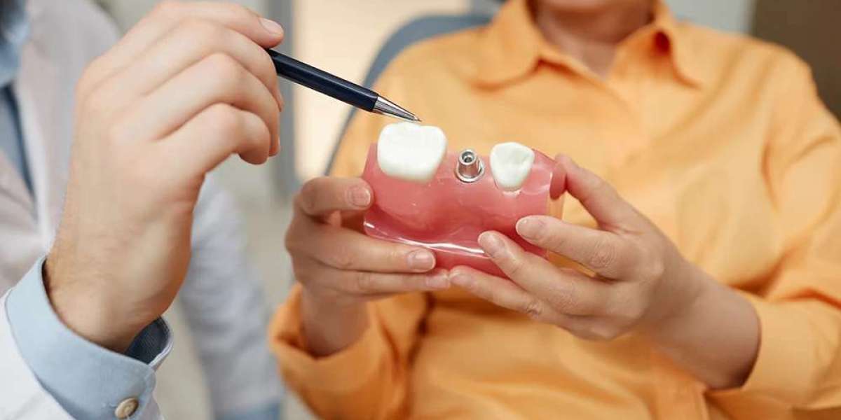 Cost of dental implants How implants improve oral health?