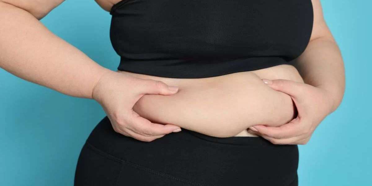 Bariatric Surgery in Islamabad – Advanced Weight Loss Care with Enfield Royal Clinic