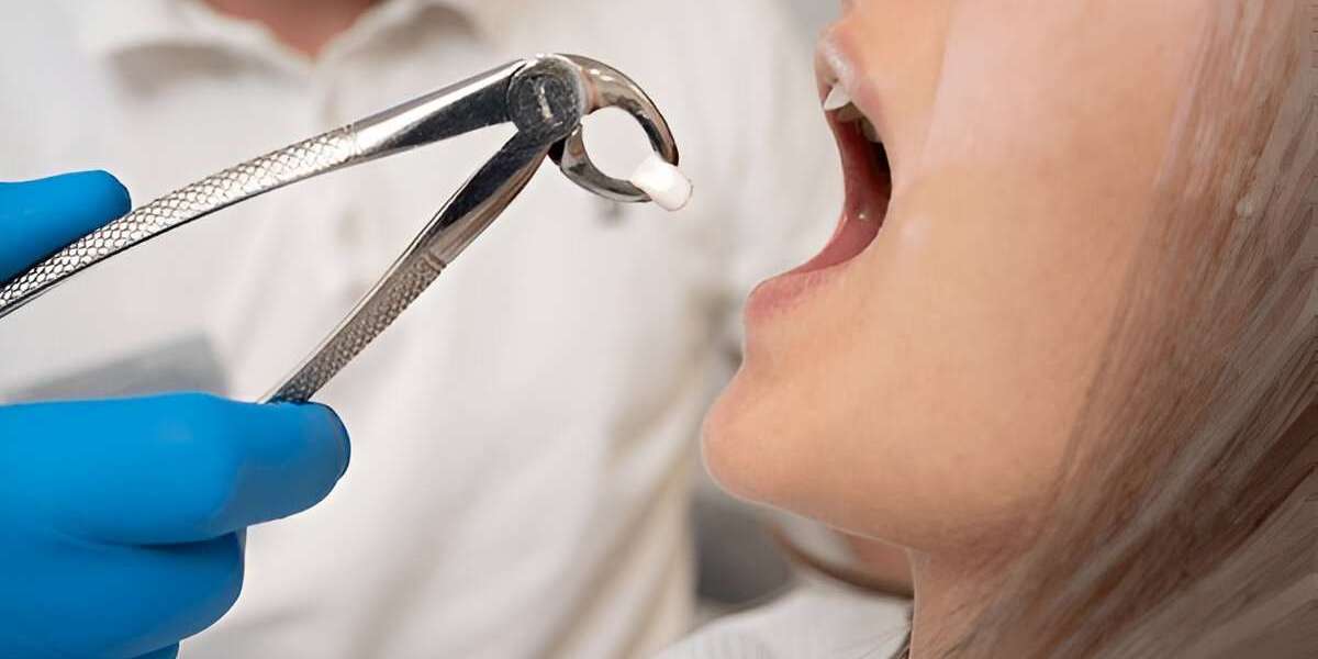 Cheapest Tooth Extraction Understanding Different Extraction Methods