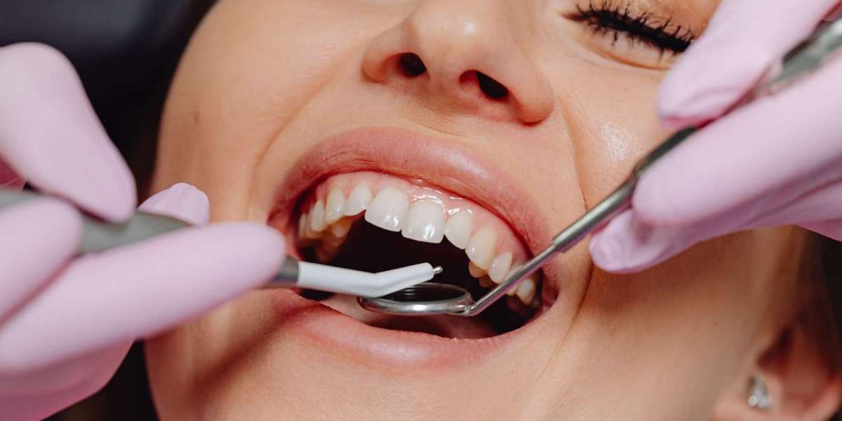 Dental Tooth Removal In Dubai Risks and Safety Guide