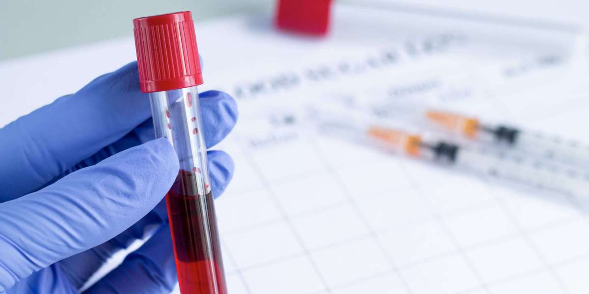 Lab Test at Home: How Technology Is Making It Easier