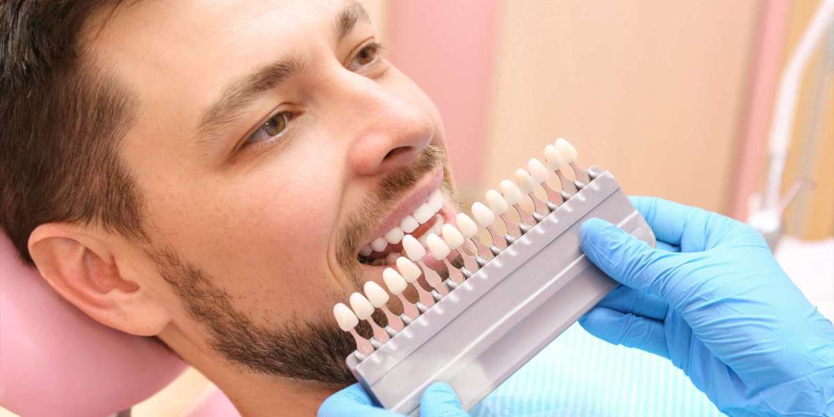 Veneers in Dubai vs Teeth Whitening Comparison