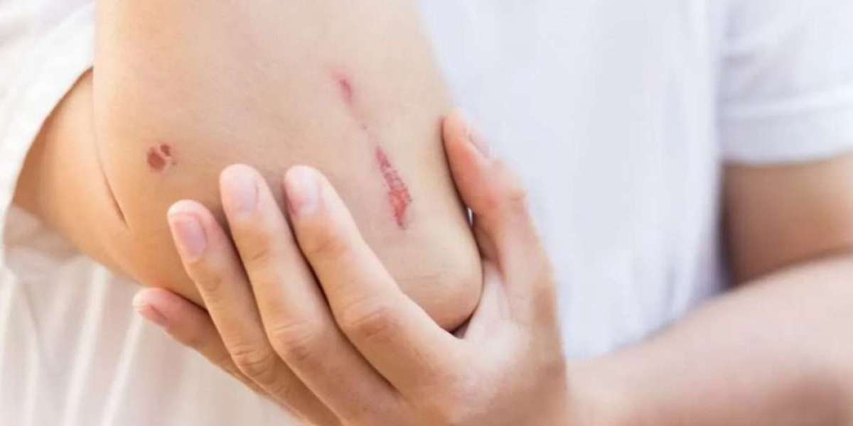 Healing laceration