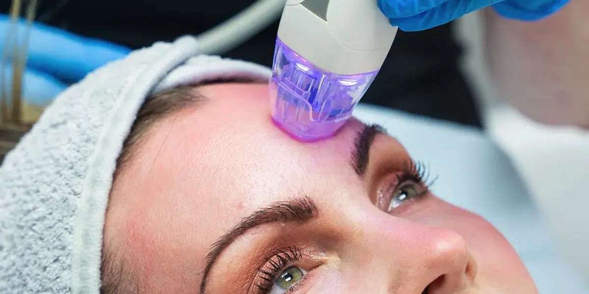 When to See Changes in Fractional RF Microneedling in Dubai?