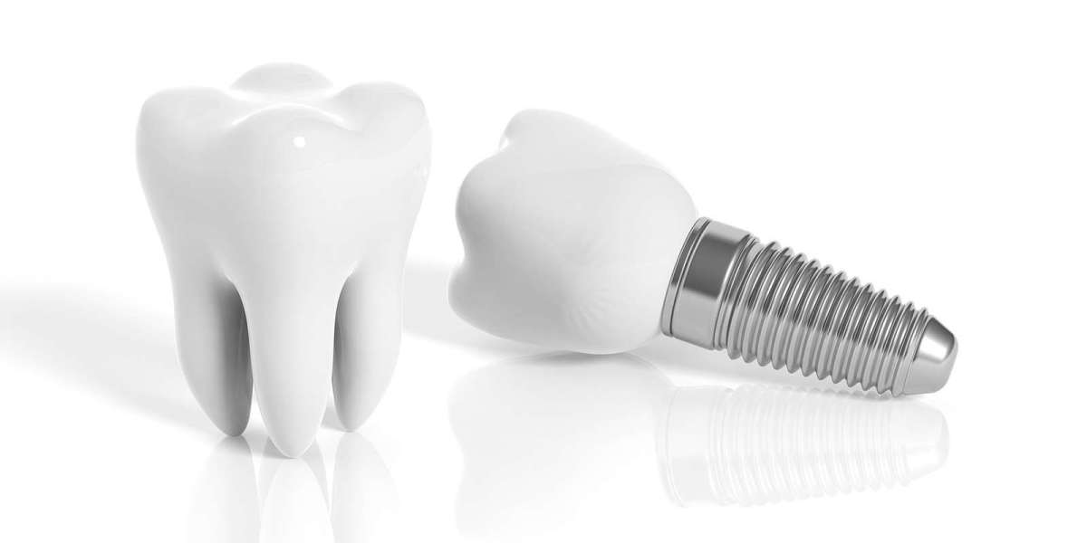 Dental Implant Cost In Dubai: Patient Guide 2026