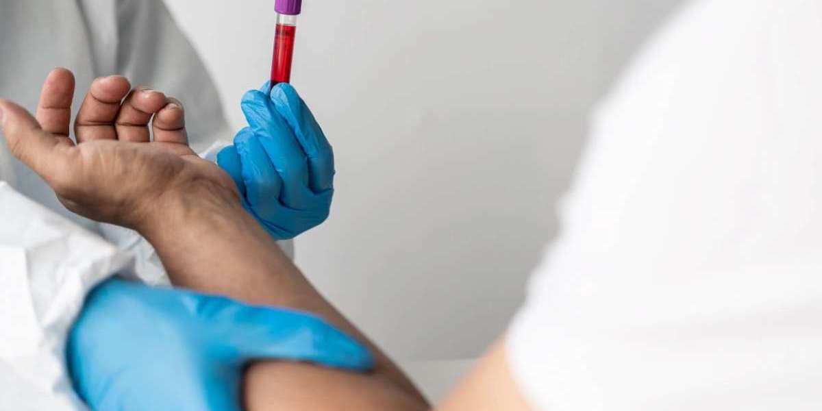 How Accurate Is a Marriage Blood Test?
