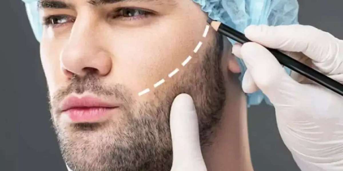 PRP Beard Growth Treatment Before and After Expectations