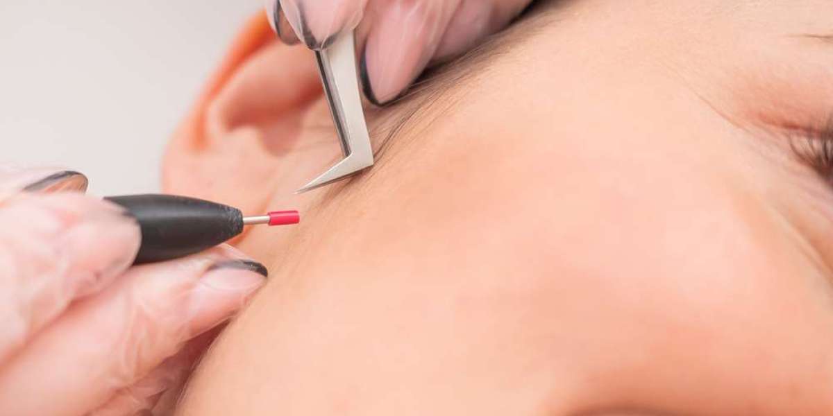 Electrolysis Laser Hair Removal Help You Maintain Silky Smooth Skin and Hair-Free Beauty