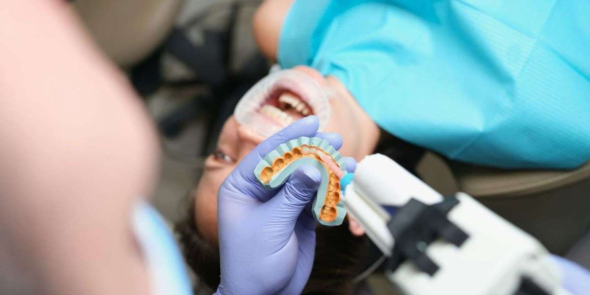 Best Dental Veneers In Dubai Treatment Timeline Guide