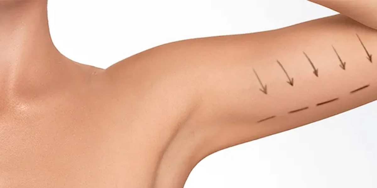 How Arm Lift Surgery Enhances Body Proportions?