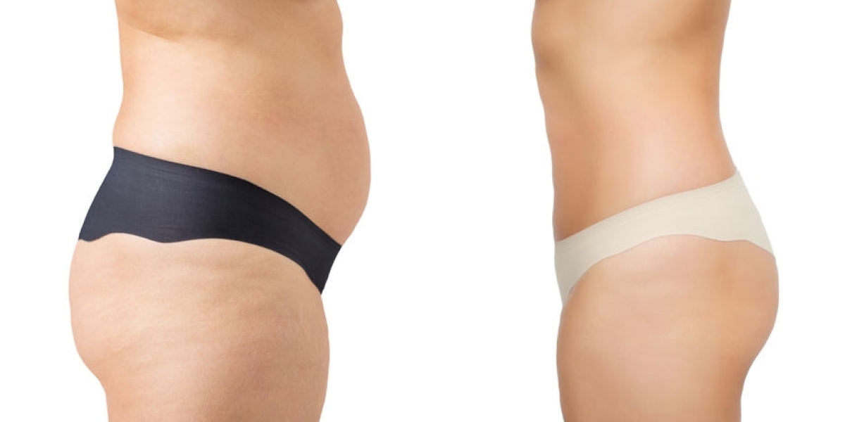 Body Fillers deliver instant smoothness and radiant body transformation effect