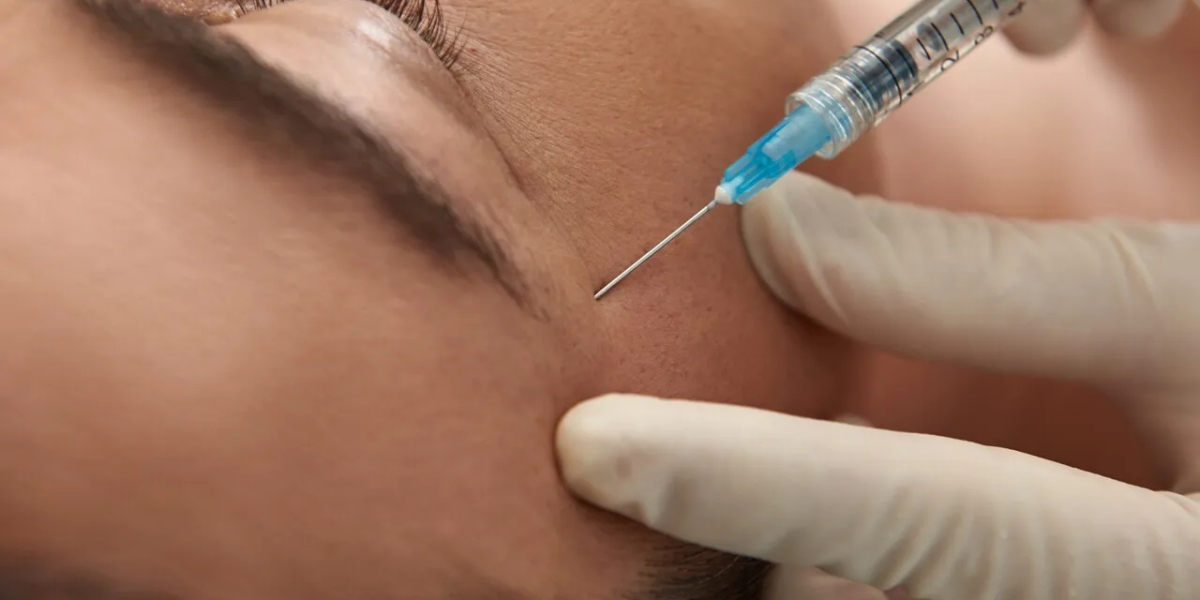 A Beginner’s Guide to Filler Injections and Skin Rejuvenation