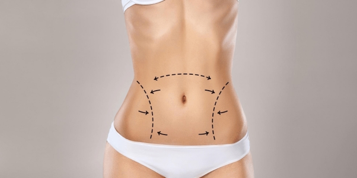 Laser Liposuction brings advanced shaping energy for elegant body lines