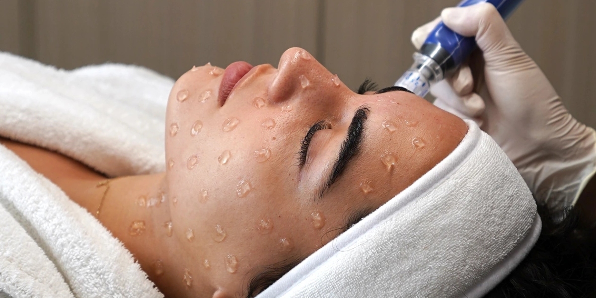 Who Needs Sessions of Fractional RF Microneedling in Dubai?
