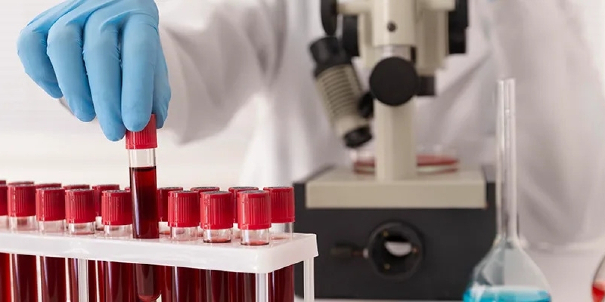 Iron Deficiency and Immune Resilience: What You Need to Know