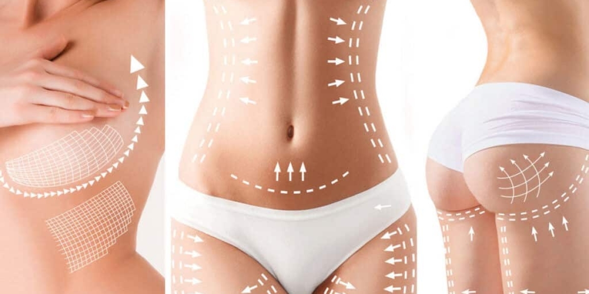 Can Butt fillers give dramatic curves and perfect body definition?