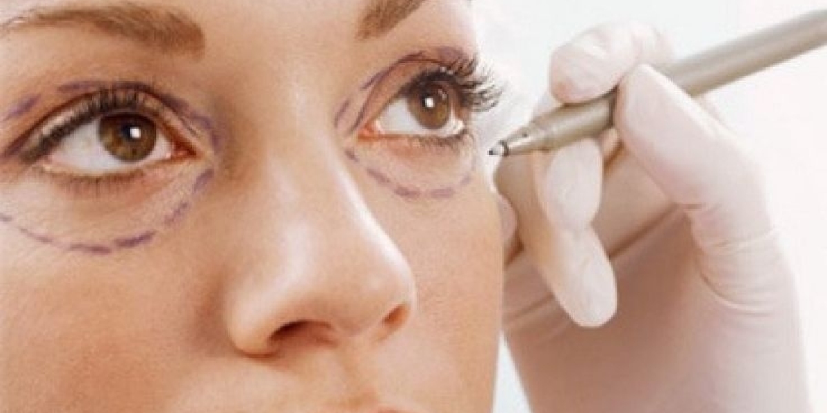 Eye Bag Removal Surgery Near Me: What to Know Before Choosing a Surgeon