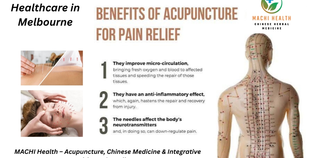 Benefits of Acupuncture in Melbourne | Natural Pain Relief & Chinese Medicine