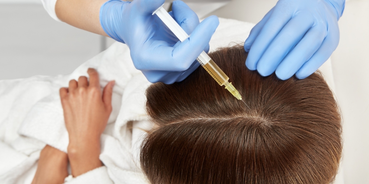 How Female Hair Transplant in Dubai Addresses Diffuse Hair Thinning