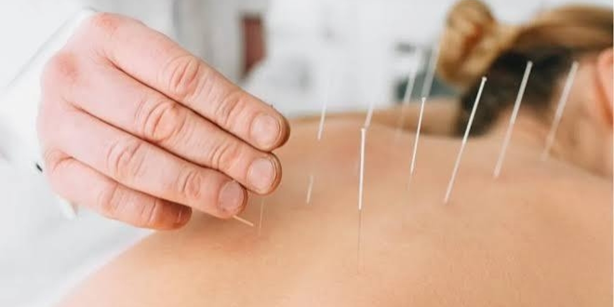 Dry Needling for Muscle Tension and Mobility
