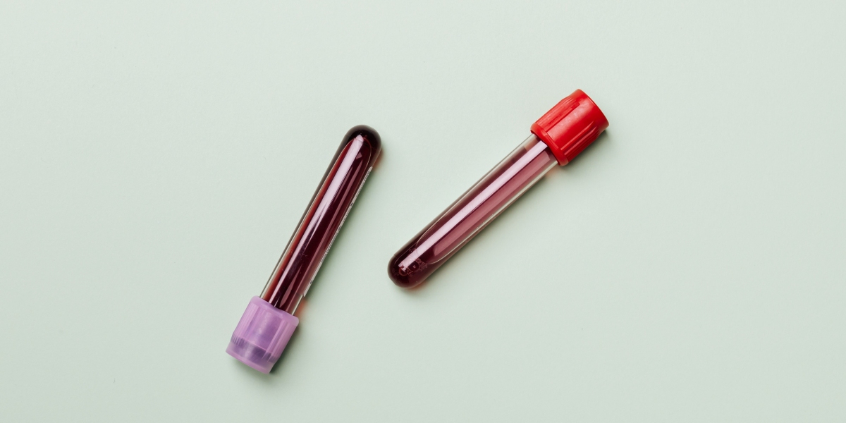 Hematology Instruments And Reagents Market | Segments, Size and Demand, Dynamics
