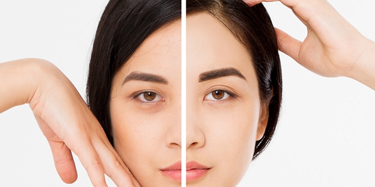 Skin Booster Treatment in Abu Dhabi: When Your Skin Needs More Than Another Cream
