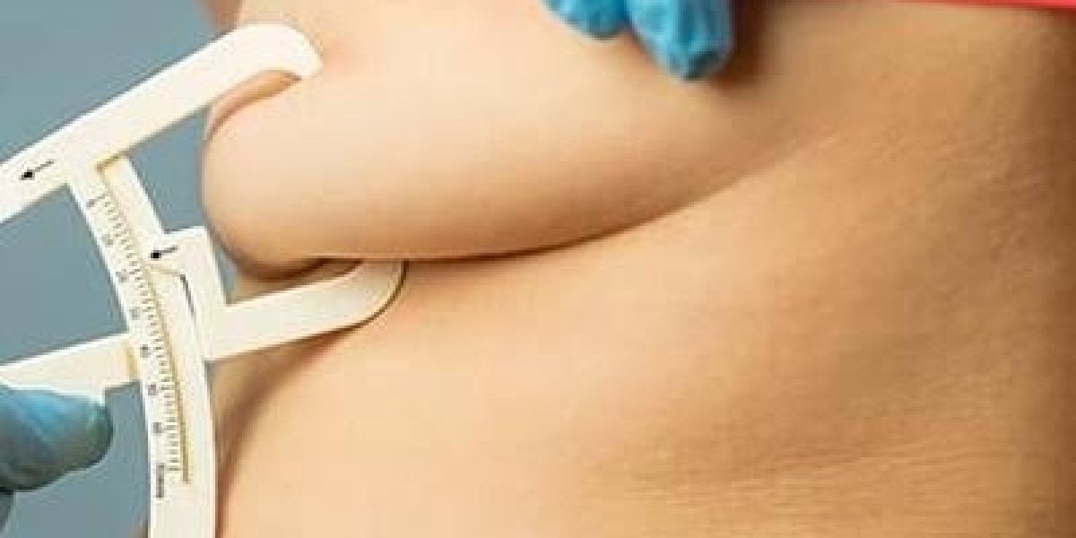 How Long Does Recovery Take After Best Liposuction in Islamabad?