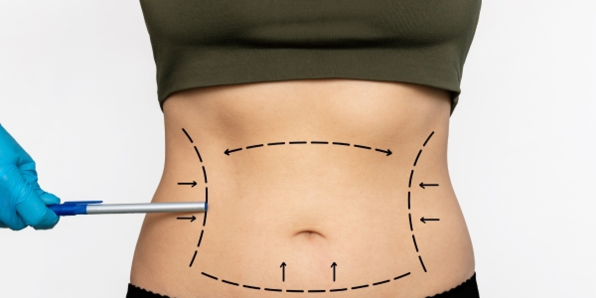 Top Trusted Names for Plastic Surgery Tummy Tuck Dubai