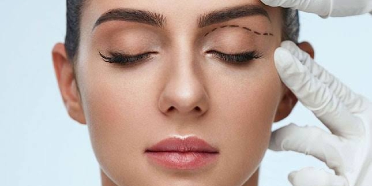 Upper Blepharoplasty In Dubai: Refine And Rejuvenate Upper Eyelids