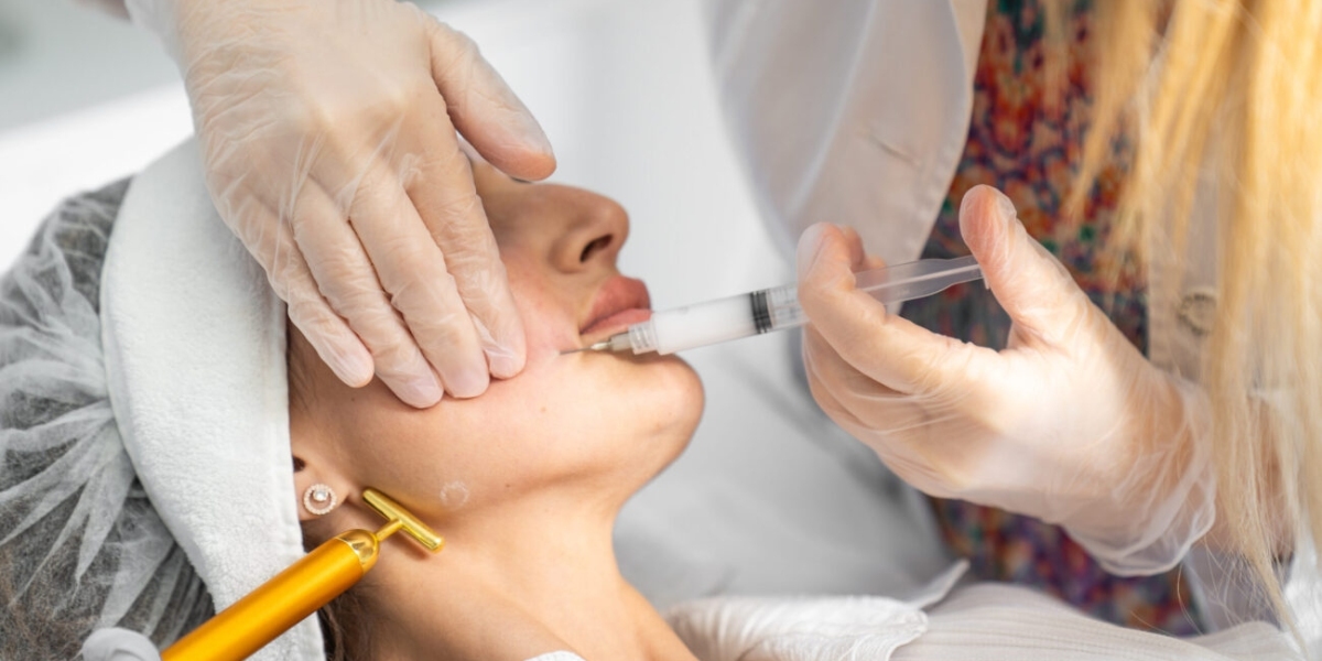 Sculptra Fillers in Dubai: How Long Do Results Last?