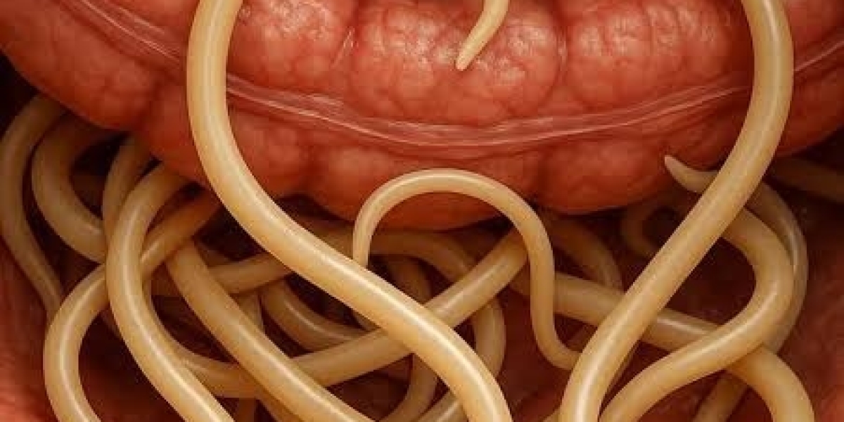 Symptoms of Worms in Stomach in Adults
